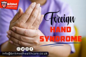 Foreign Hand Syndrome