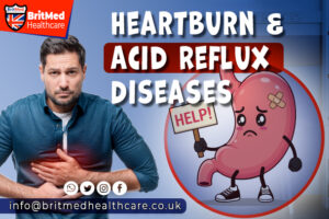 Heartburn & Acid Reflux Diseases