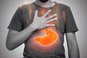 Heartburn & Acid Reflux Diseases