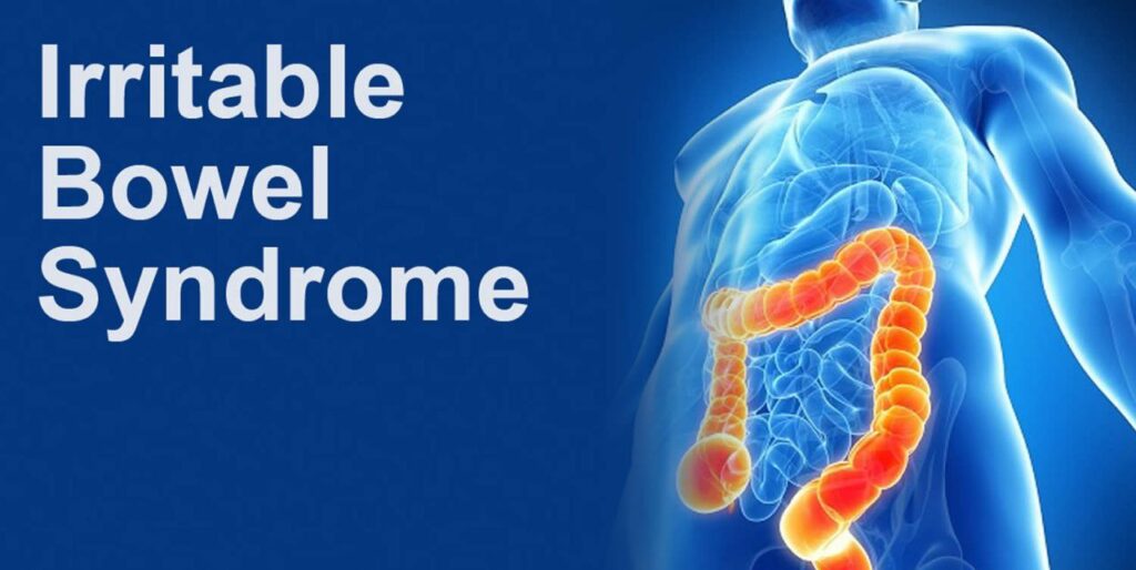 Irritable Bowel Syndrome (IBS)