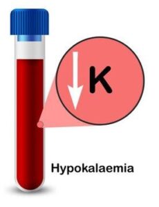 Hypokalemia